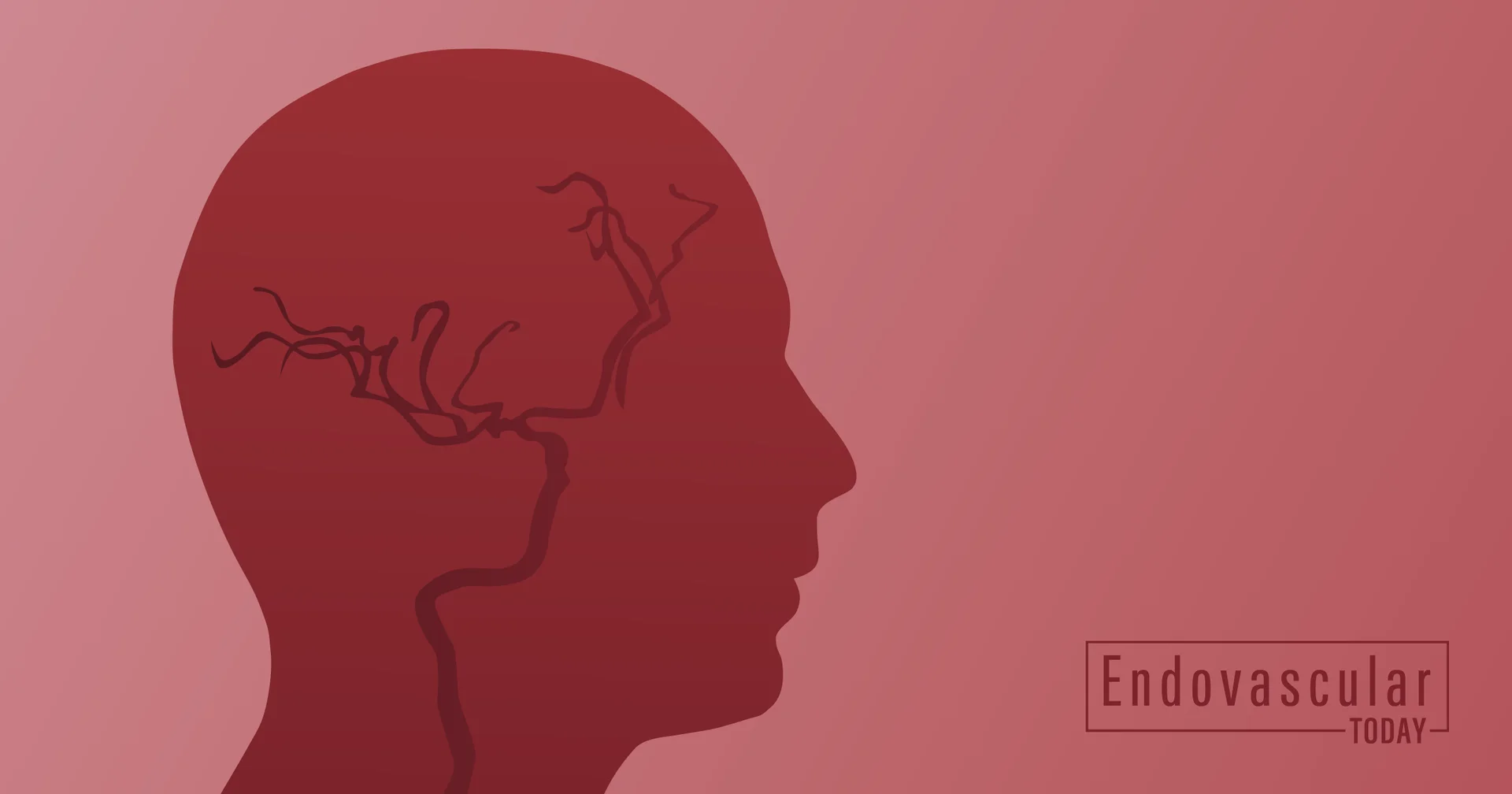 Basking Biosciences Presents Safety and Dose-Escalation Study for Reversible Thrombolytic Agent for Ischemic Stroke