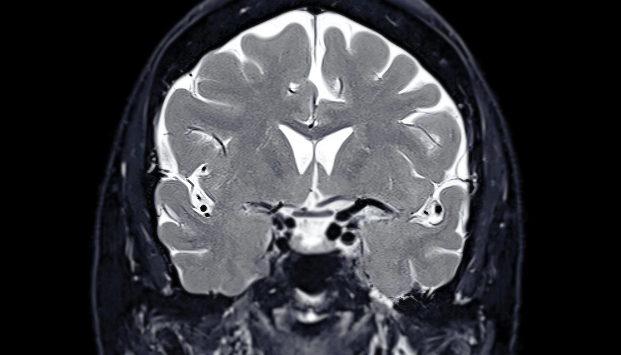 Kasvu Therapeutics goes after a different neuroplasticity target to treat depression