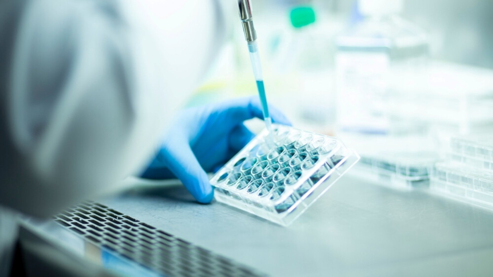 InnoCare Announces the Completion of Patient Enrollment in the Phase II Clinical Trial of ICP-488 for the Treatment of Psoriasis