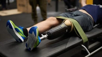Neuros Medical wins FDA approval for post-amputation pain stimulation treatment