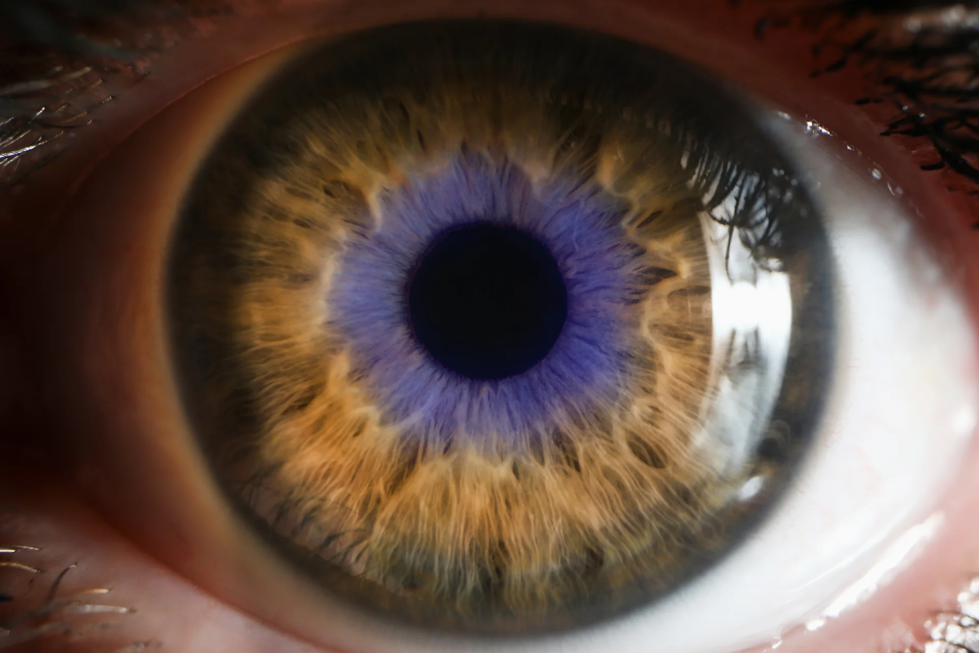 ‘This could be a large market’: Novo Holdings-backed Claris secures $118M for corneal disease drug