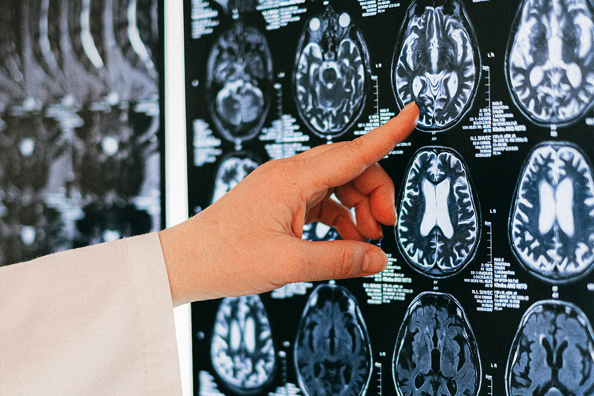 Cajal Neuro and Creyon Bio join forces on neurodegeneration