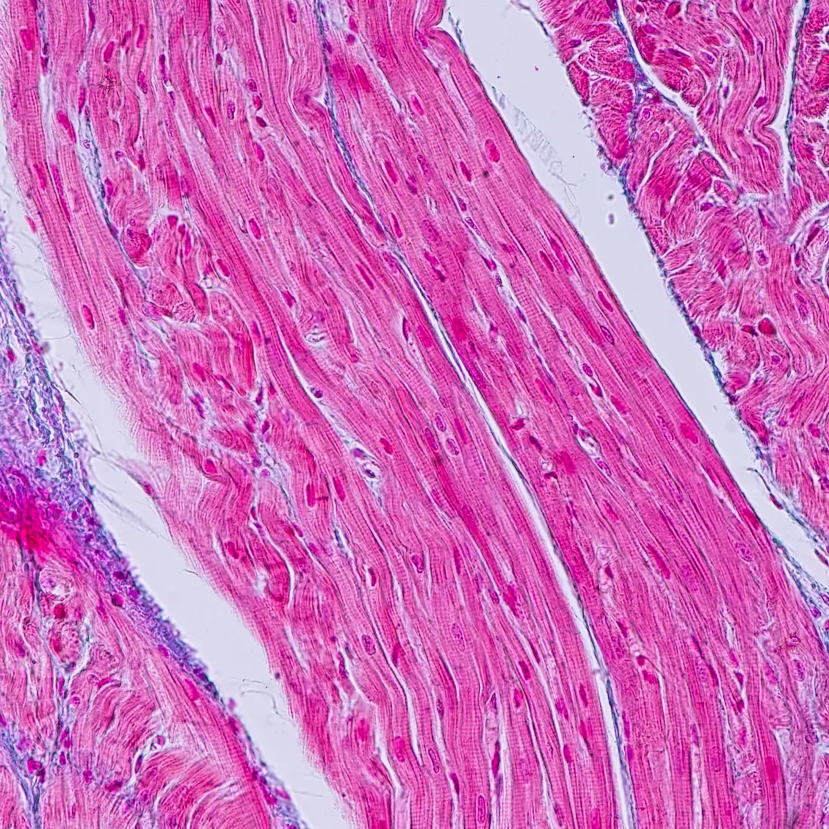 Medtronic leads $37M investment in ablation mapping startup CoreMap