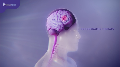 Alpheus Medical Initiates Phase 2b Trial of Investigational Therapy for Newly Diagnosed Glioblastoma