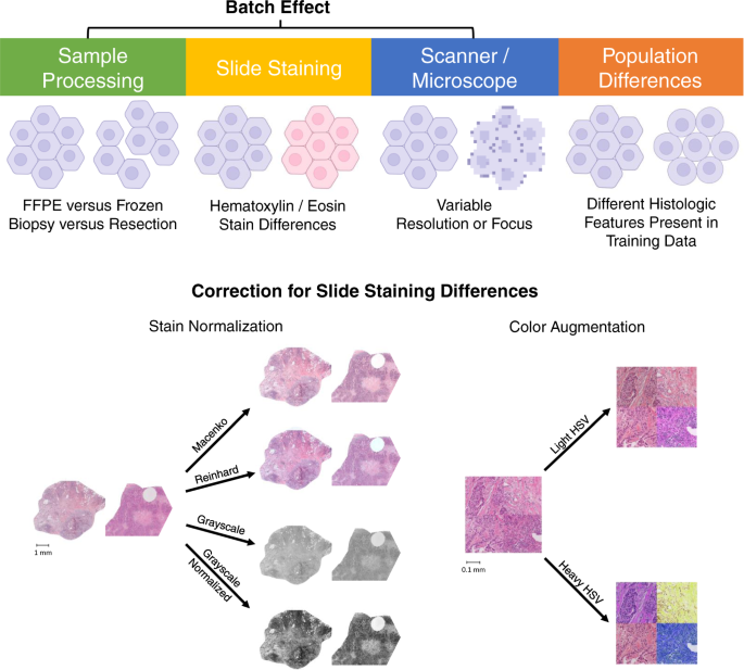 The impact of site-specific digital histology signatures on deep learning model accuracy and bias