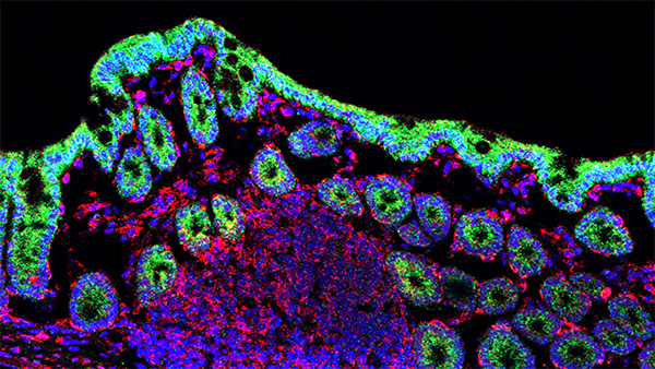 Kanvas Biosciences Raises USD 48M to Advance Microbiome Cancer Therapies