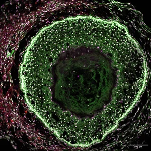 Gameto Licenses Foundational Meiosis IP from Harvard to Advance Human Ovary-in-a-Dish Platform