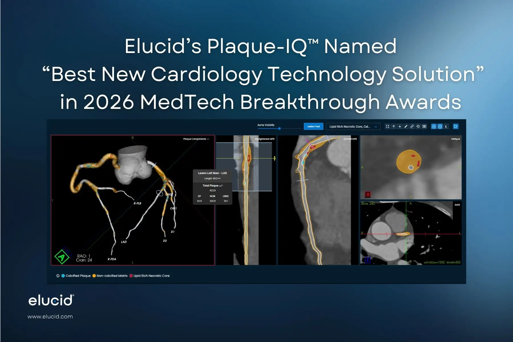 Elucid's Plaque-IQ Named Best New Cardiology Technology Solution in 2026 MedTech Breakthrough Awards Program