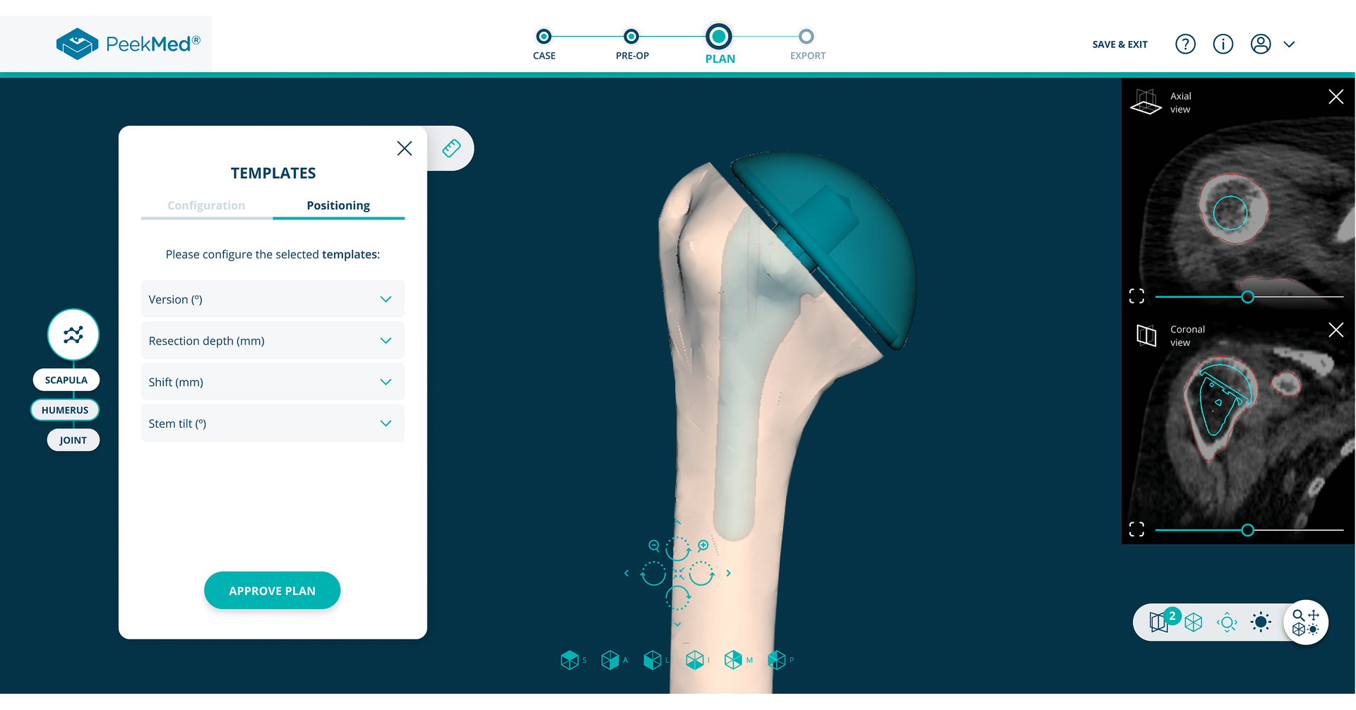 PeekMed® Unveils New Automated Orthopedic Solution for the US