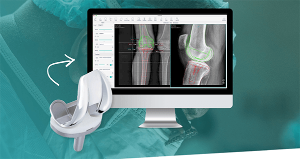 GOeasy Signs Agreement for AI Pre-Op Planning