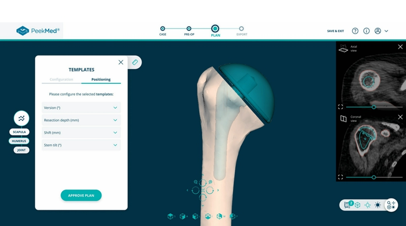 PeekMed Launches Advanced AI Solution to Revolutionize Orthopedic Surgery in the US