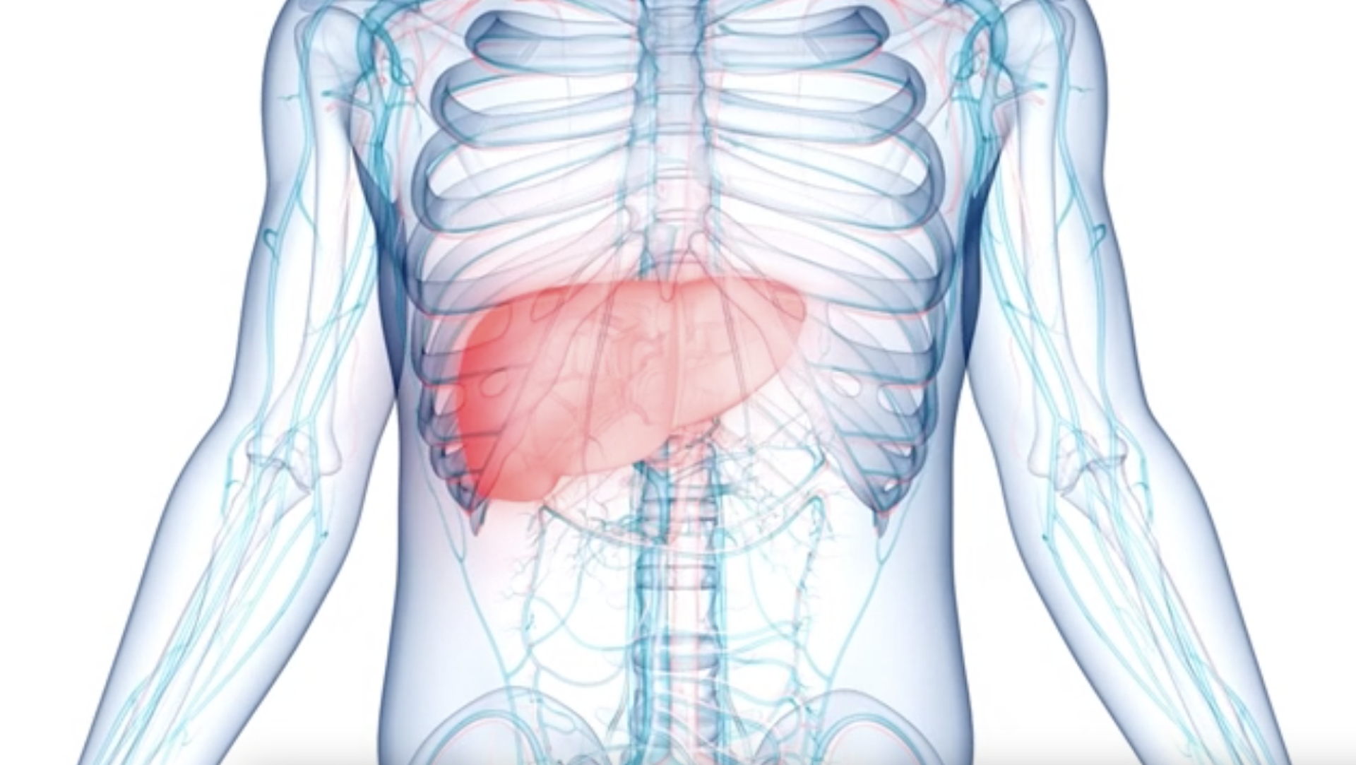 USC Norris collaborates with Auransa on clinical trial of new targeted treatment for liver cancer