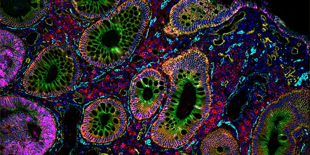 Agents for Spatial Biology