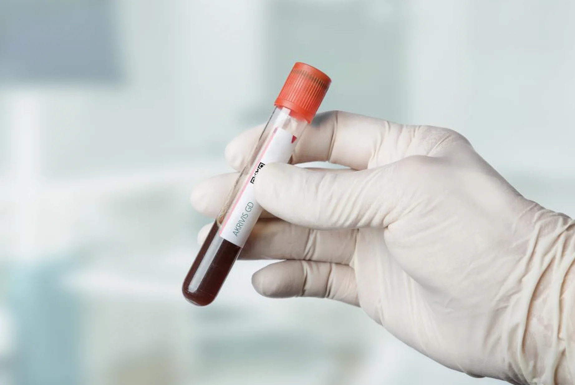 US biotech start-up raises US$17m to develop ovarian cancer diagnostic test