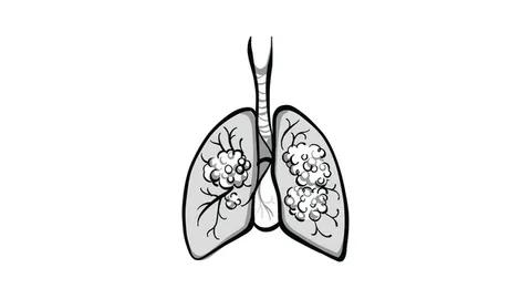 China’s NMPA to Review NDA of Zorifertinib for EGFR-Mutated NSCLC With CNS Metastases | Targeted Oncology - Immunotherapy, Biomarkers, and Cancer Pathways