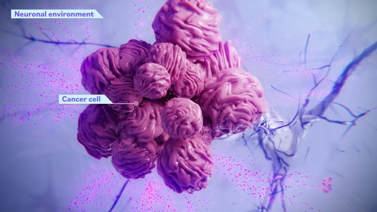 Alpheus Medical Raises $52M to Advance Glioblastoma Therapy