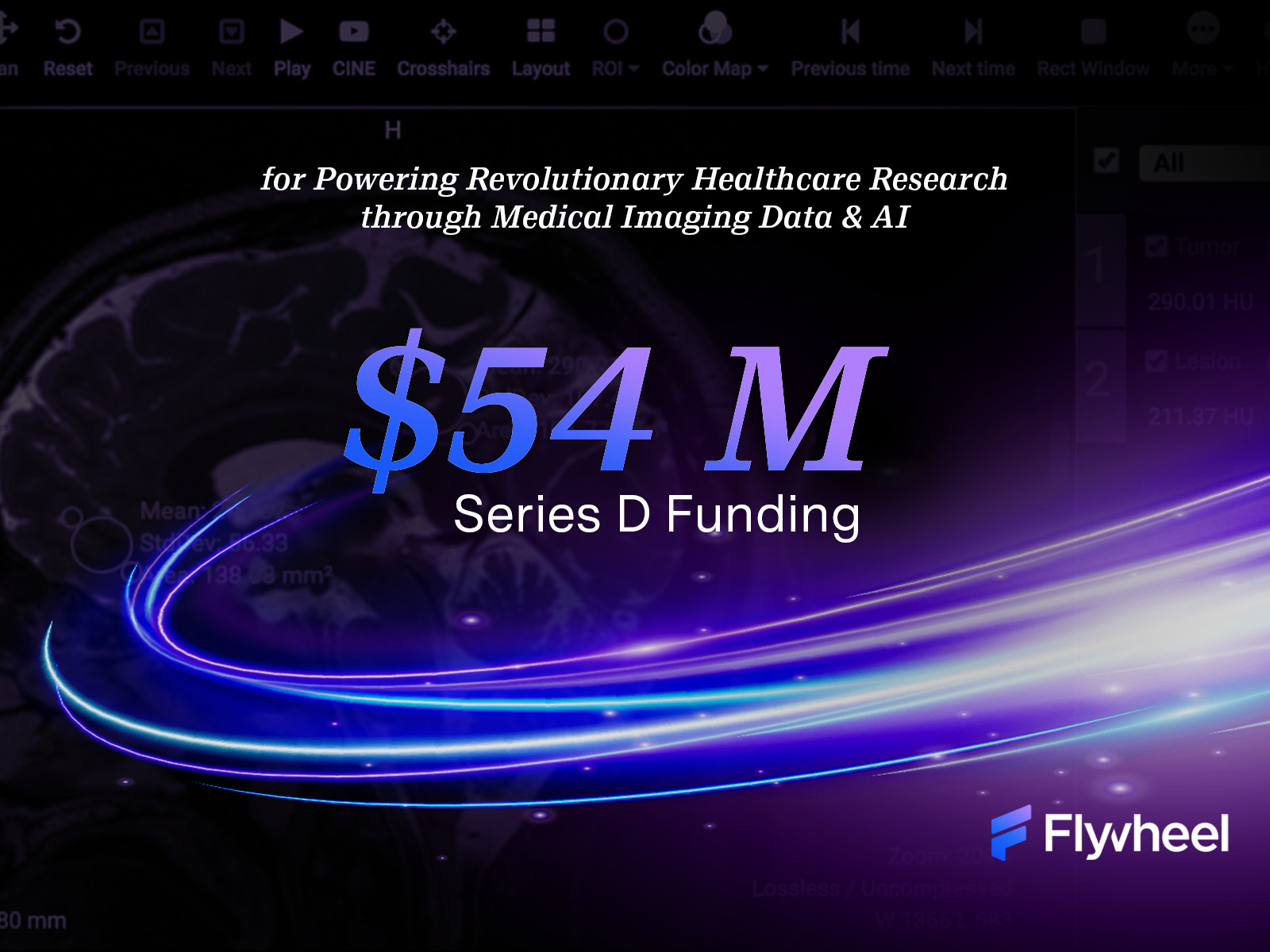 Revolutionizing Medical AI Development: Flywheel Announces $54 Million in Series D Funding led by Novalis LifeSciences and NVentures