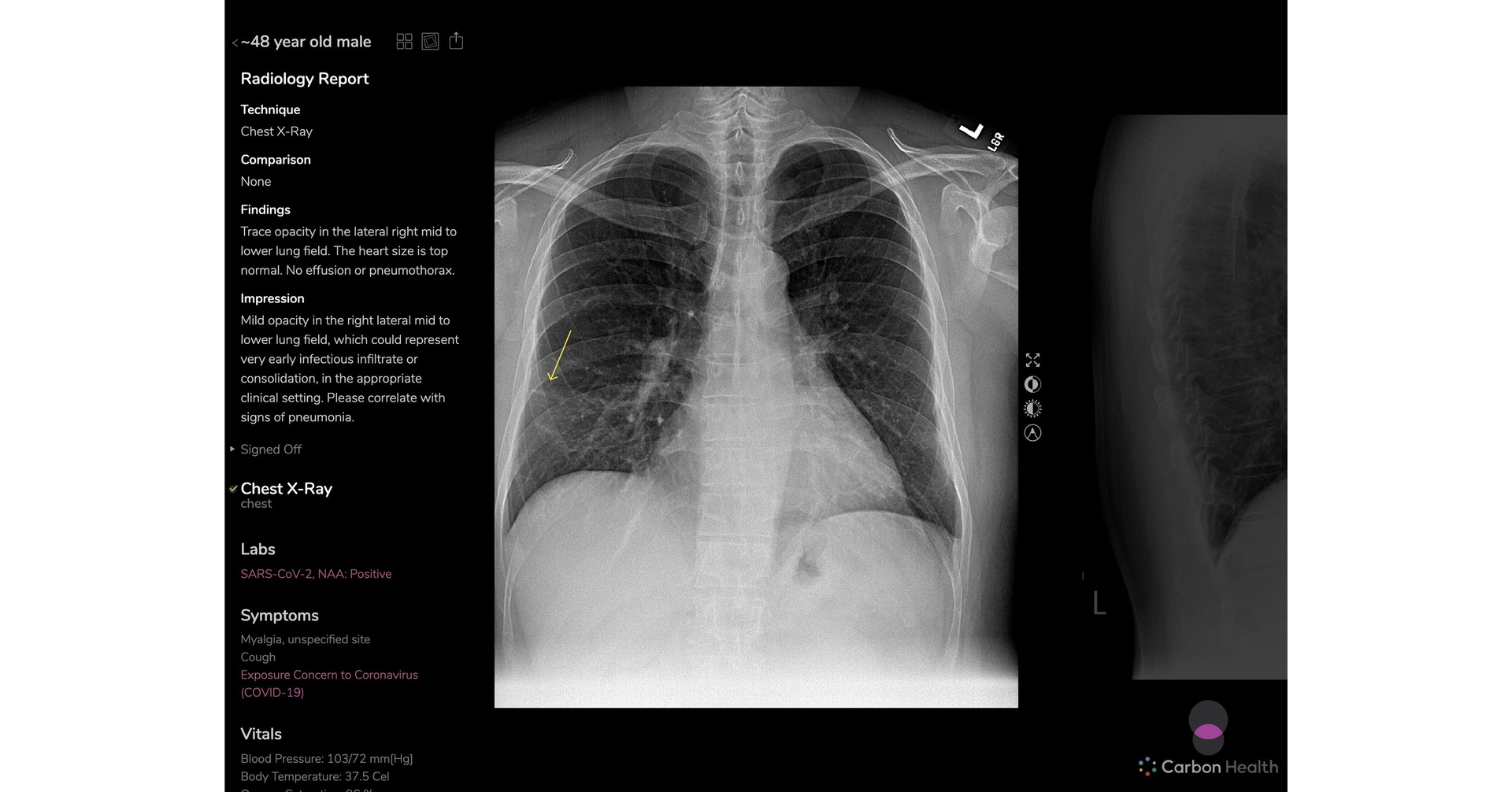 Carbon Health Urgent Care Clinics Deliver Next Generation Diagnostic Imaging Results with Radiology Platform from Braid Health