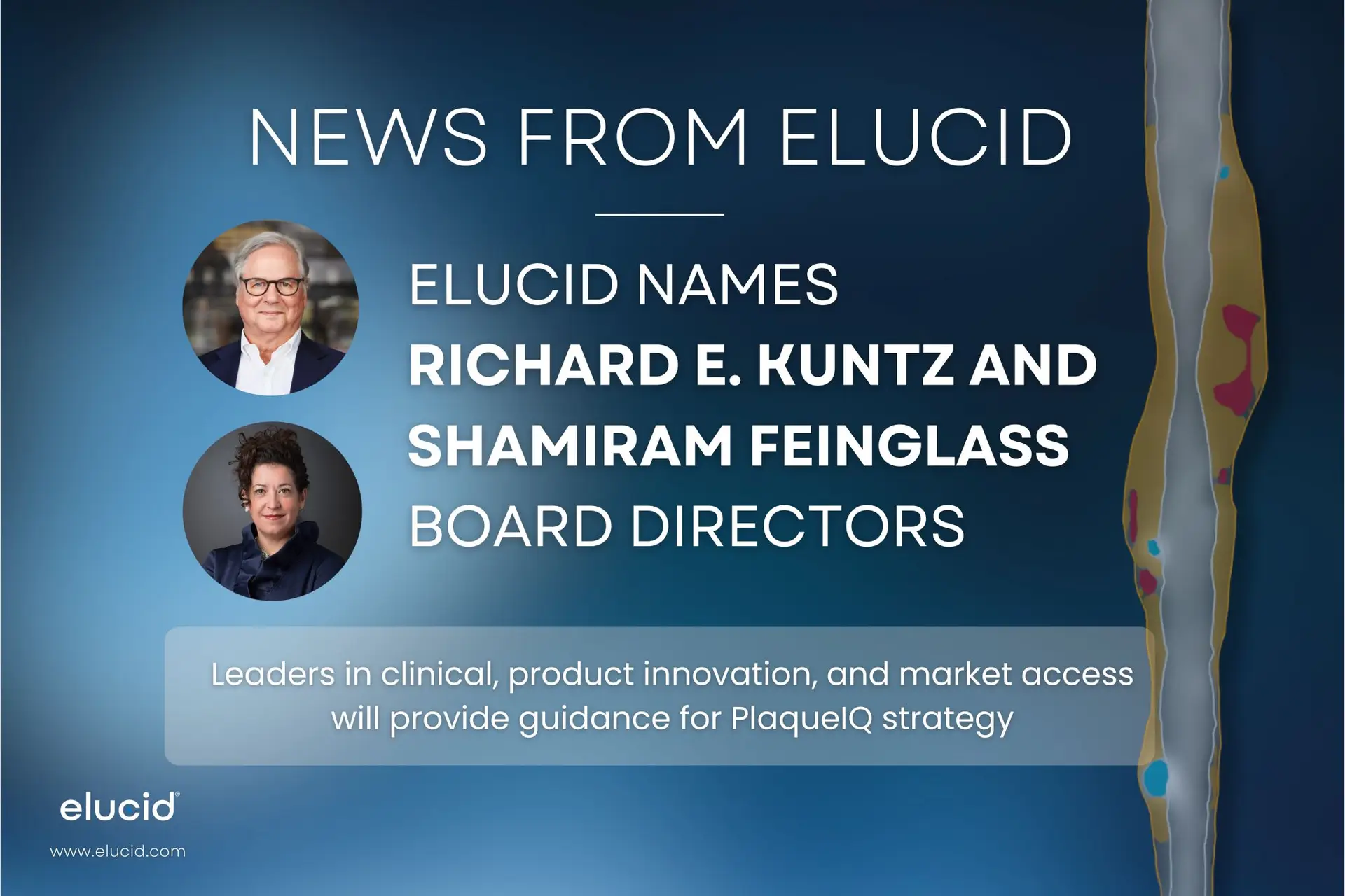 Elucid Names Richard E. Kuntz, MD, MSc and Shamiram Feinglass, MD, MPH Board Directors