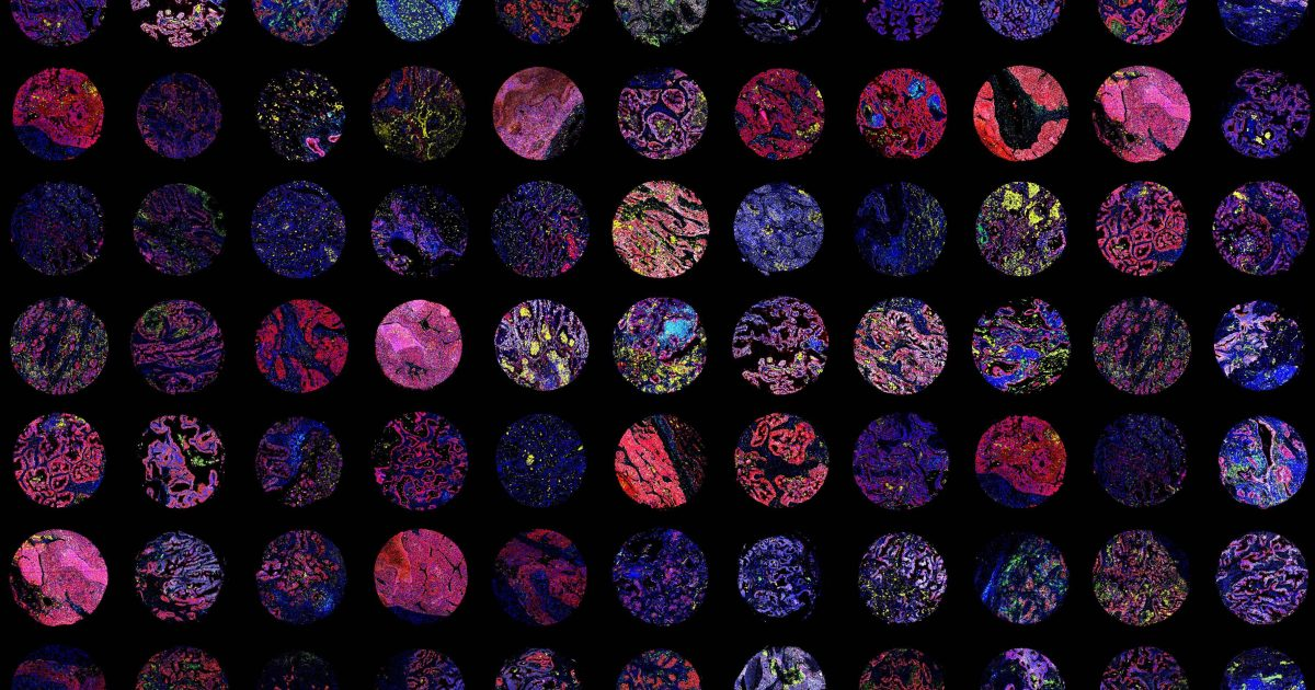 Noetik's partnership with GSK puts dollar signs on the AI licensing business model in TechBio
