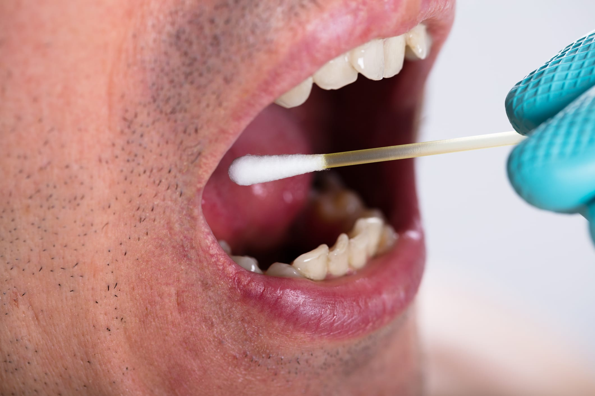 NIH Grant Supports Development of Rapid Chairside Oral Cancer Test