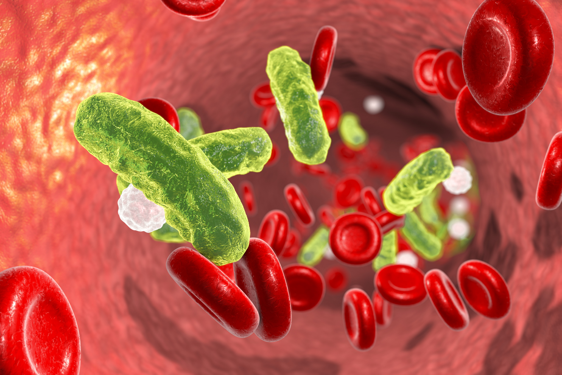 Inflammatix Scores FDA Approval for Precision Infection Test