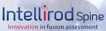 Intellirod Spine
